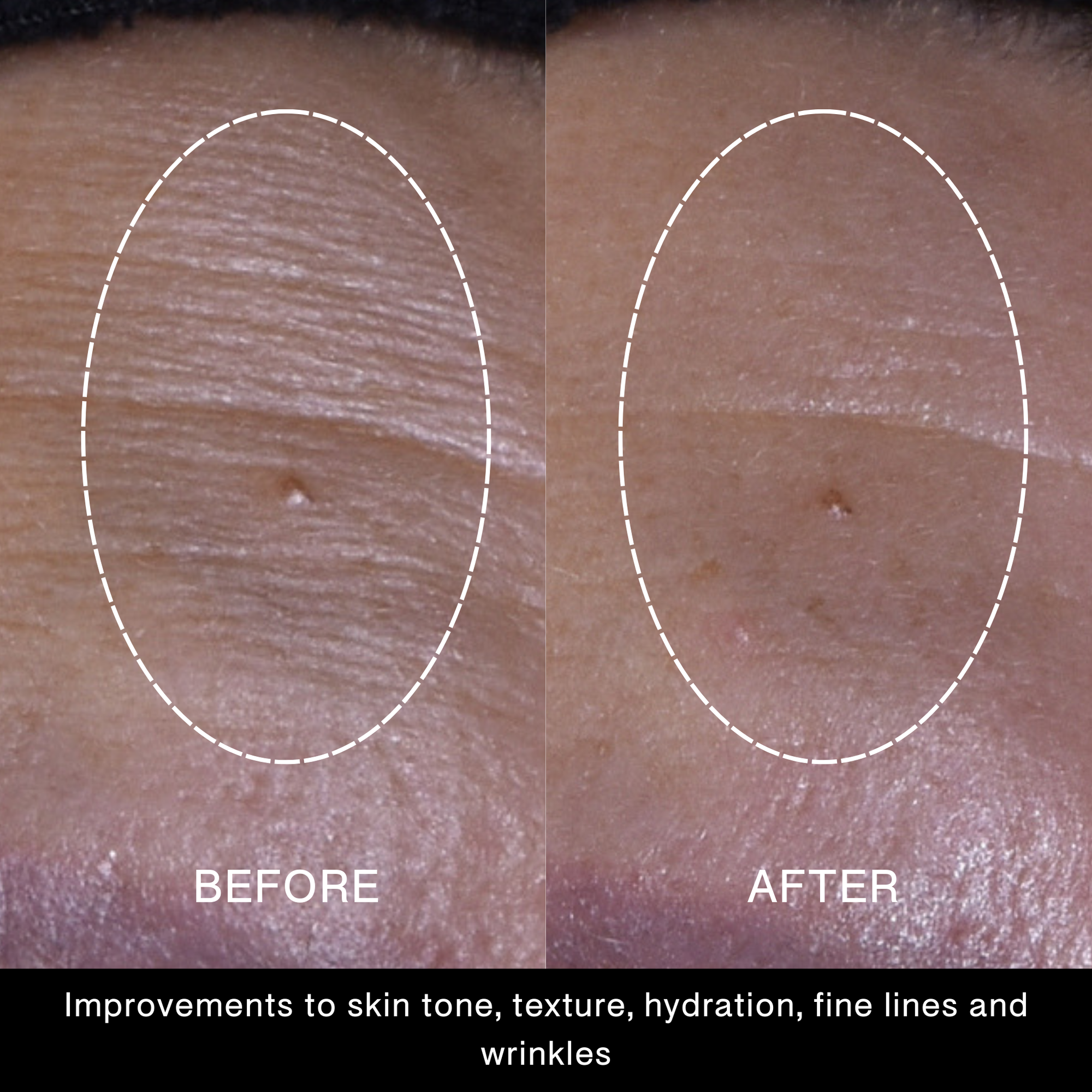 Power Up Silk Concentrate