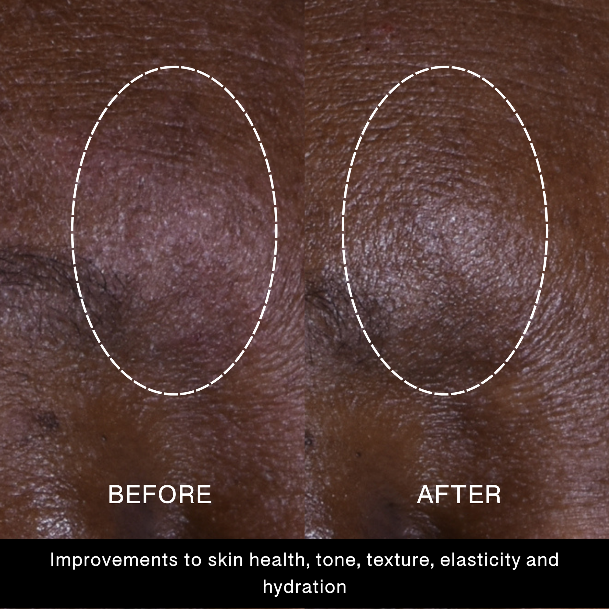 Power Up Silk Concentrate