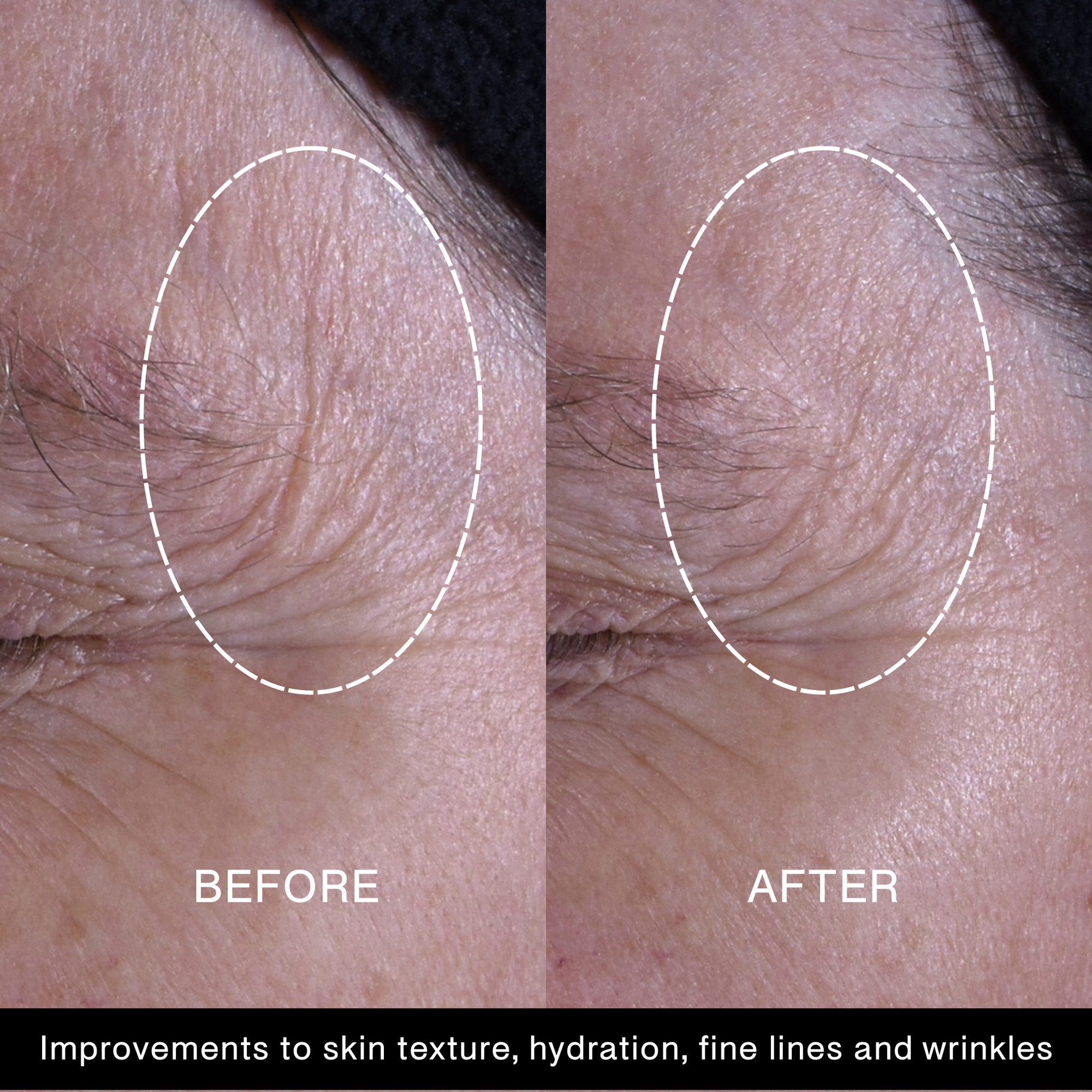 Power Up Silk Concentrate