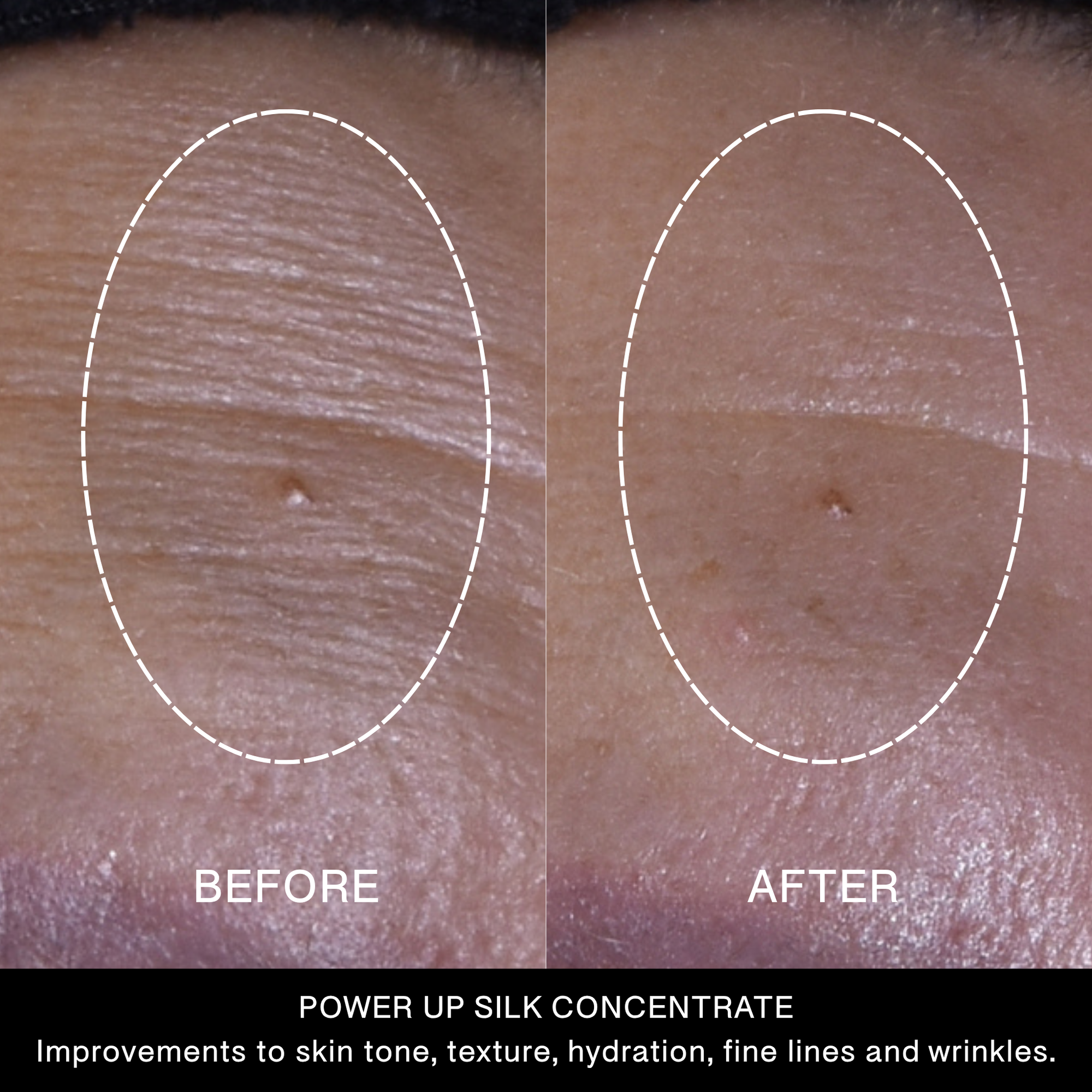 Skin Regeneration Duo
